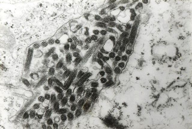 virus-microscopio-640