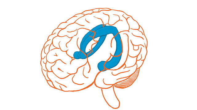 cerebro