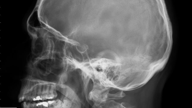 radiografias