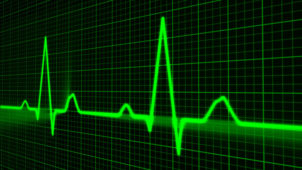 cardiovascular